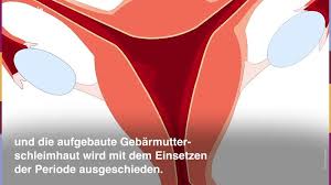 Wann kommt periode nach ausschabung? Ausschabung 5 Wichtige Dinge Die Du Daruber Wissen Solltest