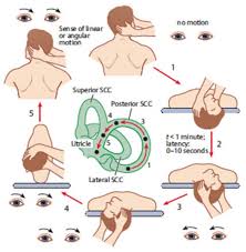 Image result for Canalith Repositioning Procedure