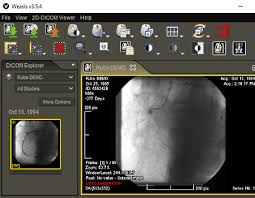 You can download free dicom software. 6 Best Free Open Source Dicom Viewer Software For Windows