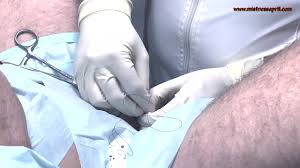 Mistress April and MsKitten transforming in their clinic a slave from a he  into a she - XNXX.COM