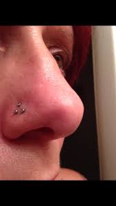 An abscess may be formed as a result of accumulation of pus and blood in the pierced area. What Does A Nose Piercing On The Right Side Indicate Quora