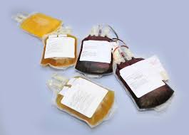 Image result for Plasma Transfusion