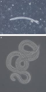 Image result for Strongyloides