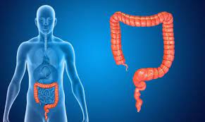 The symptoms of hemorrhoids (also called piles) and bowel cancer can be quite similar but do not have the same fatal results. The Difference Between Colon Cancer And Hemorrhoids