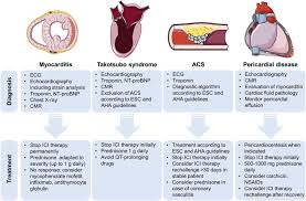 Although these categories extend the definition of myocarditis beyond the narrow. Cardiotoxicity From Immune Checkpoint Inhibitors Sciencedirect