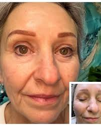 Beautiful results warming up and camouflaging aged micro blading strokes  with fresh powder brows. Client was delighted.