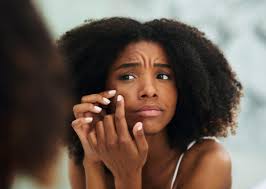 Check spelling or type a new query. Hormonal Acne Causes And Treatment