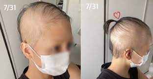 사실 둘 다 백신을 맞는 게 중요하지 무엇을 맞는지는 전혀 중요하지 않다고 생각했지만, 굳이 선택을 할 수 있게 되니 이것저것 생각은 해봤습니다. 2ns7m Mscwyymm