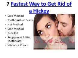 Check spelling or type a new query. How To Get Rid Of Hickies Fast In A Day Health Wises