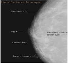 Pin On Mammography