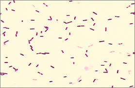 A microbial biorealm page on the genus listeria monocytogenes. Coloracion De Gram De Cultivo De Liquido Cefalorraquideo Se Observan Download Scientific Diagram