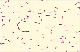 Listeria monocytogenes is a bacterium that causes listeriosis, a disease that can have severe description of the organism. Coloracion De Gram De Cultivo De Liquido Cefalorraquideo Se Observan Download Scientific Diagram