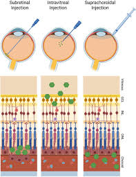 Image result for Dark Hunter Green 1996 AAV
