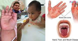 Tidak dipungkiri lagi bahwa kita hanyalah menunggu waktu untuk kembali. Elak Bawa Bayi Bawah 6 Bulan Ke Tempat Awam Doktor Kata Baby Chair Punca Jangkitan Virus Hfmd Pa Ma