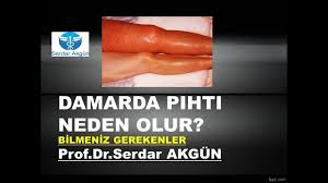 Damarda Pihti Neden Olur Youtube
