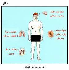 عيادة عقبة جبر اريحا aqbat jaber clinic jericho اعراض مرض الايدز facebook