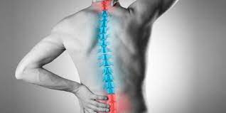 Berikut info lengkap berkaitan sakit belakang atau penyebab sakit pinggang belakang tengah yang sering berlaku dan tak patut dipandang ringan. Sakit Tulang Belakang Mula Menyerang Ini Sebabnya