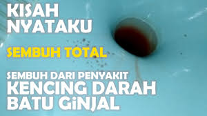 Obat kencing berdarah ace maxs merupakan cara mengobati kencing berdarah secara herbal paling ampuh, karena obat herbal kencing berdarah ace maxs ini obat terbaik kencing berdarah. Air Kencing Gelap Dalam Kucing Sebab Dan Rawatan Petua Berguna