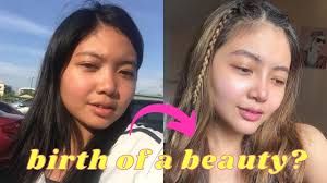 RETALK-E: Nose, Chin and Cheeks, Tune in as I walk you through my plastic  sur-journey. :D Almost four months after I first went under the knife, I  decided to have my chin and cheeks enhanced, too! , ...