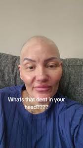 Random questions flooding my inbox so here is your answer... #chemotherapy  #fyp #brainhemmorhage #breastcancer #survivor