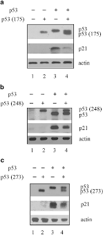 Investigation dna proteins and mutations answers : Mutant P53 Exerts A Dominant Negative Effect By Preventing Wild Type P53 From Binding To The Promoter Of Its Target Genes Oncogene