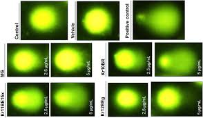 We scrape the web for freebies. Chemical Characterization And In Vitro Cyto And Genotoxicity Of Legal High Products Containing Kratom Mitragyna Speciosa Springerlink