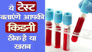 Pin On Symptoms Of Kidney Infection