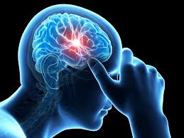 Image result for what happens in the brain when one is suffering from headaches