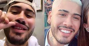 Mc kelvinho e mc dimenor. Lente De Contato Dental Conheca O Procedimento Feito Pelo Cantor Kevinho