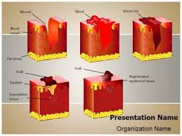 Dermatology Wound Healing Powerpoint Template Is One Of The