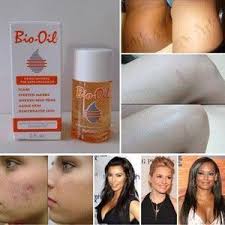 Before And After Result Bio Oil Dry Skin Gel Review Facescrubhomemadeoilyskin Body Skin Care Healthy Skin Tips Bio Oil Stretch Marks