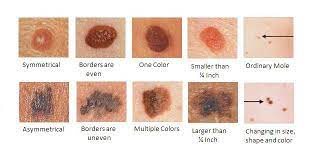 Pin On Everything Health
