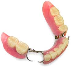 A partial denture is a dental appliance worn as a replacement for missing teeth. Rhee Dentistry Palm Coast Dentist
