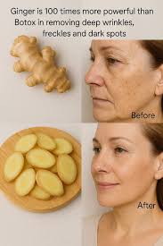 Ginger removes deep wrinkles and dark spots