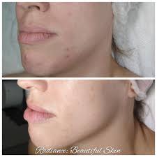 Top Skincare Services in Overland Park