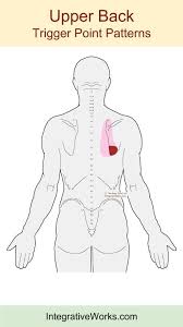 Pin On Trigger Points On The Body