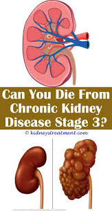 In this article, we discuss the essential information you. Kidney Disease Cats Kidney Disease Kidney Disease Diet Kidney Disease Symptoms