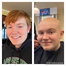 Celebrating a decade of going Bald for Bucks: Austin's story