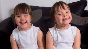 Down S Syndrome Twins Are One In A Million Youtube