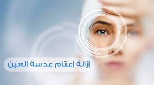 المياة البيضاء عمليات إزالة إعتام عدسة العين تركي ويز