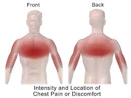Many of the people suffer from pain in upper thoracic spine and upper back after prolonged sitting; Chest Pain Wikipedia