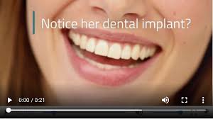 In a clinical trial, prosthodontists experiment with untested techniques, materials, and appliances. How Can I Get Free Dental Implants Dental News Network