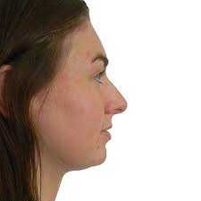 Cosmetic Surgery, Plastic Surgery & Breast Surgery Specialists