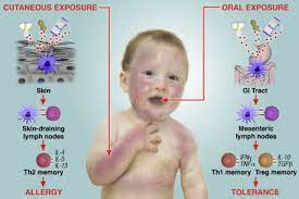 Epidemiologic Risks For Food Allergy Journal Of Allergy And Clinical Immunology