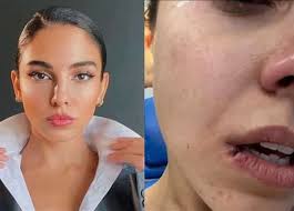 شاركت النجمة سلمى ابو ضيف متابعيها بصورة من أحدث ظهور لها أثناء قضائها إجازتها الصيفية، وذلك عبر حسابها الشخصي على موقع تبادل الصور والفيديوهات انستجرام. Lquienap1bggsm