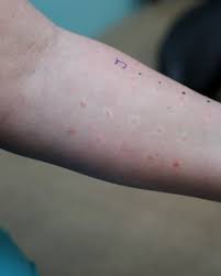 Image result for Wheal