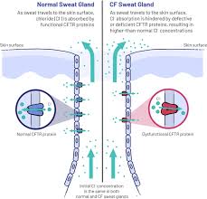 Image result for Sweat Chloride