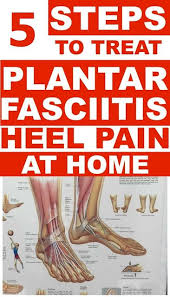 Home Remedies For Plantar Fasciitis In 2020 Plantar Fasciitis Treatment Plantar Fasciitis Plantar Fasciitis Remedies