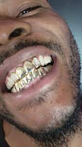 Check spelling or type a new query. Gold Plugz Gold Teeth Home Facebook