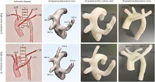 This position is halfway between a posterior and anterior position. Three Dimensional Printed Model Fabrication And Effectiveness Evaluation In Fetuses With Congenital Heart Disease Or With A Normal Heart Huang 2021 Journal Of Ultrasound In Medicine Wiley Online Library
